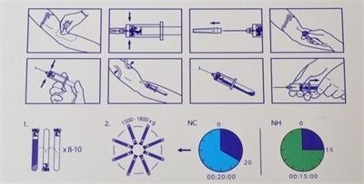6/8x15 ml draagbare PRP-centrifuge 0-4000 rpm Voor cosmetische chirurgie ziekenhuizen
