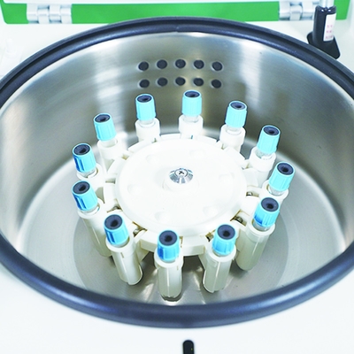 Professionele tafel- multifunctieve celwasser Centrifuge Rode bloedonderzoek